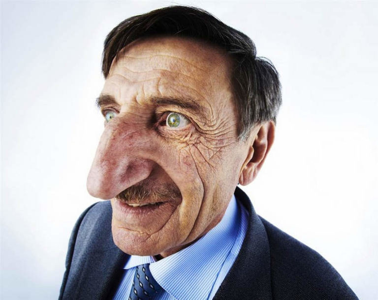 Самый длинный нос: Мехмет Озюрек